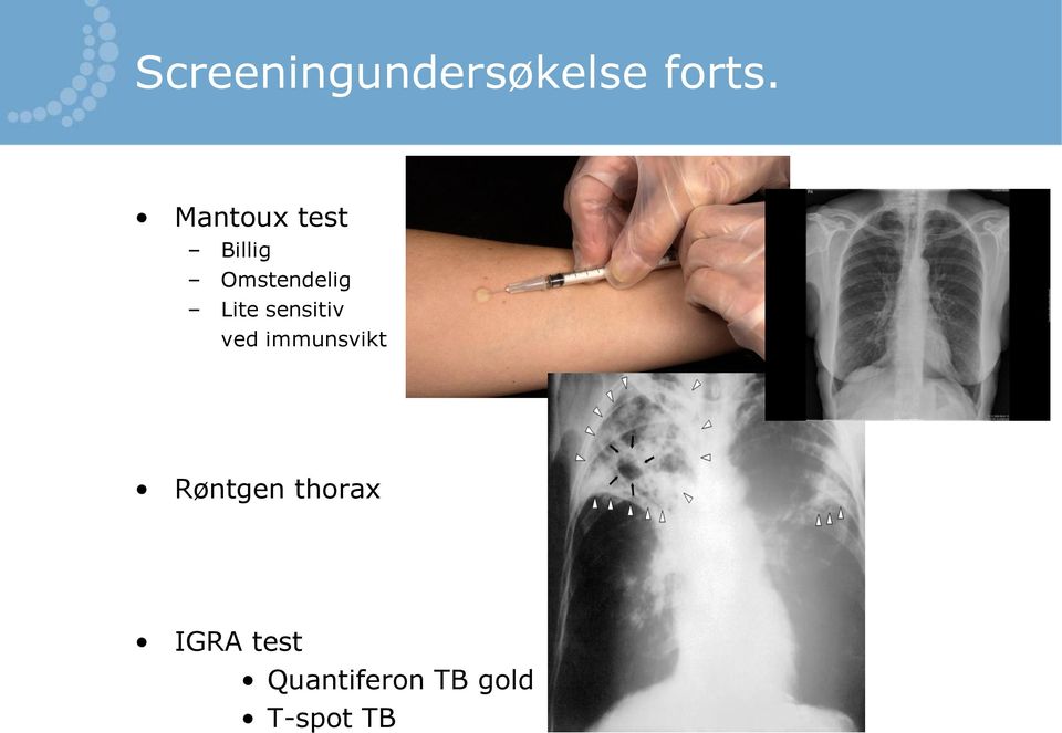 Lite sensitiv ved immunsvikt