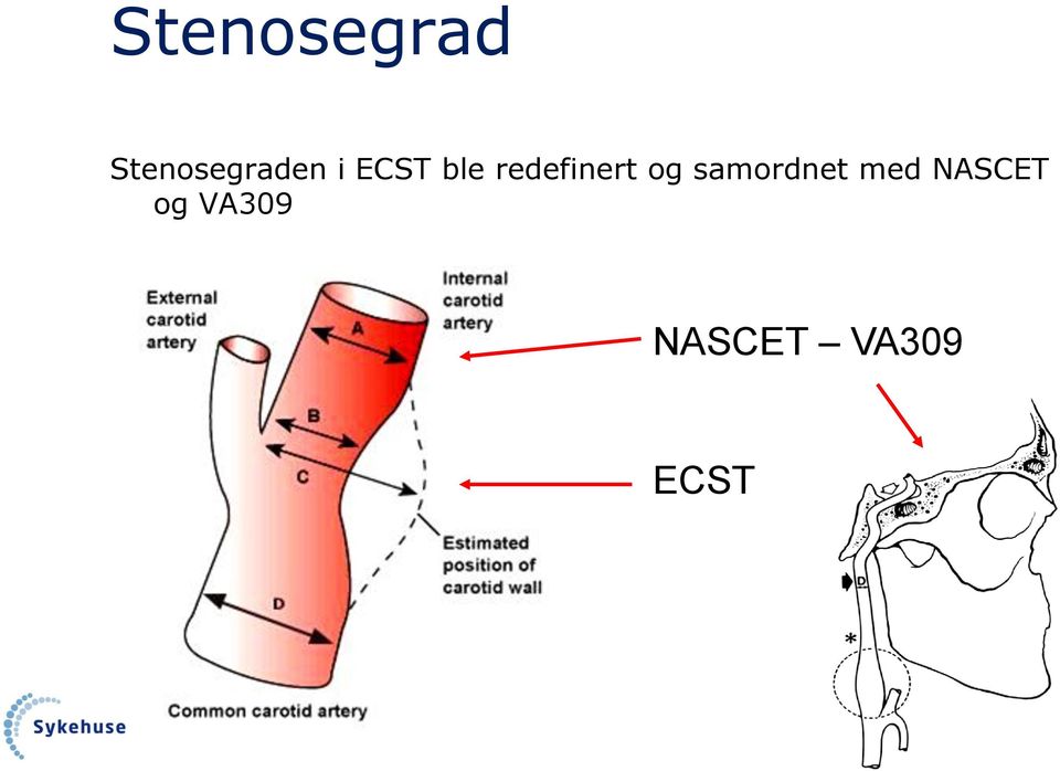 og samordnet med NASCET