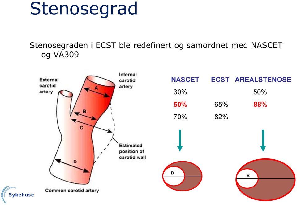 NASCET og VA309 NASCET ECST