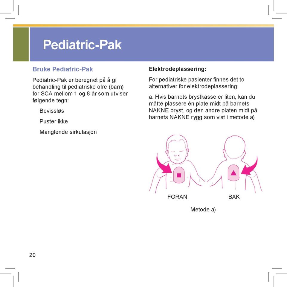 pasienter finnes det to alternativer for elektrodeplassering: a.