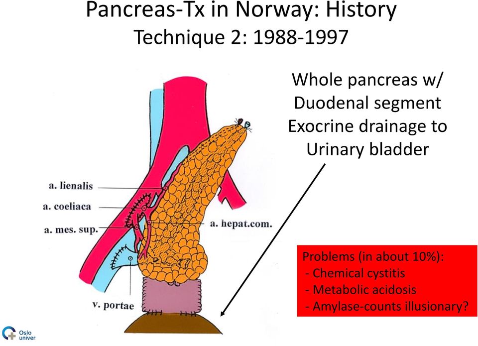 Urinary bladder Problems (in about 10%): - Chemical