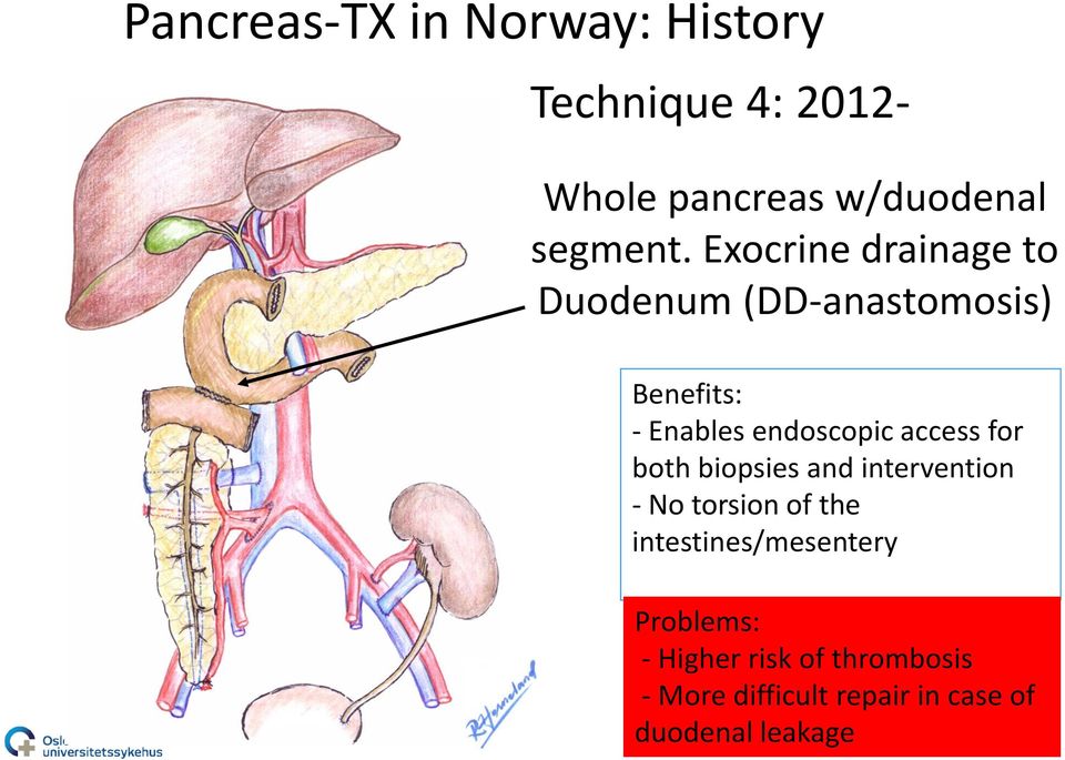 access for both biopsies and intervention - No torsion of the intestines/mesentery