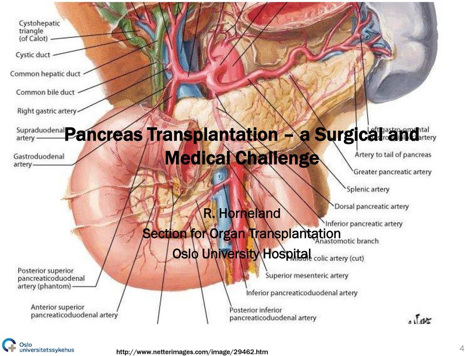 Horneland Section for Organ Transplantation