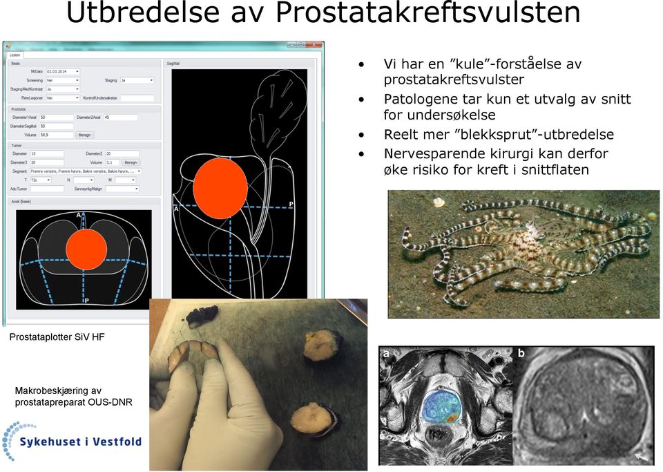 Patologene tar kun et utvalg av snitt for undersøkelse Reelt mer blekksprut