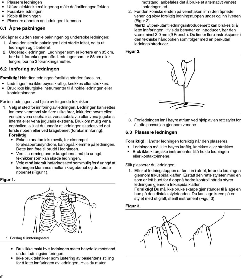 Ledninger som er kortere enn 85 cm, bør ha 1 forankringsmuffe. Ledninger som er 85 cm eller lengre, bør ha 2 forankringsmuffer. 6.