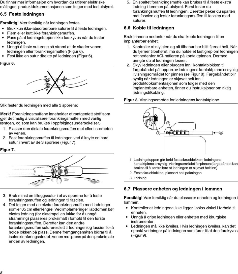 Unngå å feste suturene så stramt at de skader venen, ledningen eller forankringsmuffen (Figur 6). Fest ikke en sutur direkte på ledningen (Figur 6). Figur 6.