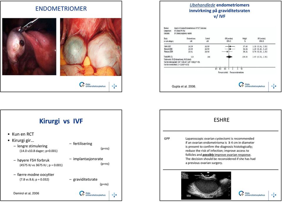 001) fertilisering (p=ns) implantasjonsrate (p=ns) GPP Laparoscopic ovarian cystectomi is recommended if an ovarian endometrioma is 4 cm in diameter is present to confirm the