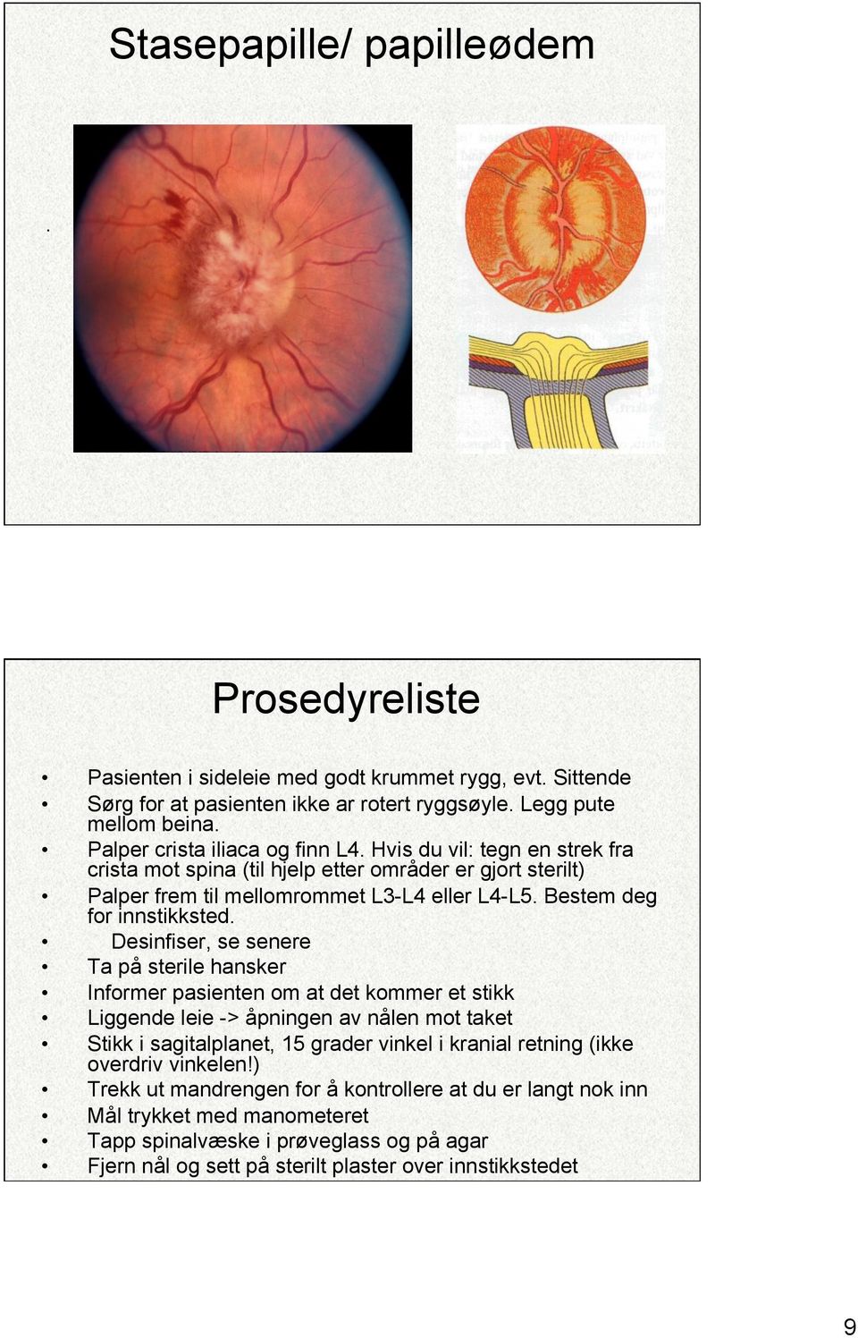 Bestem deg for innstikksted.