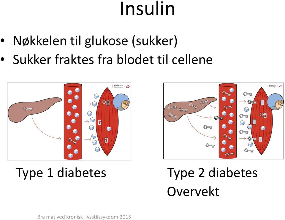 blodet til cellene Type 1