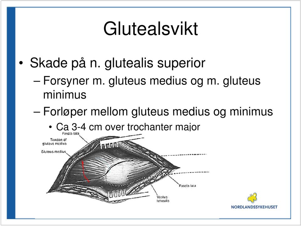 gluteus medius og m.