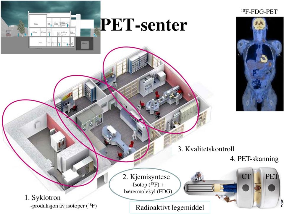 Syklotron -produksjon av isotoper ( 18 F) 2.