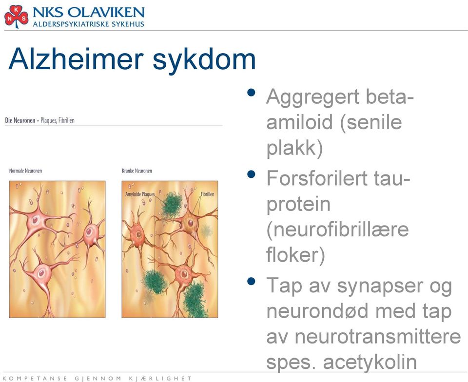 (neurofibrillære floker) Tap av synapser og