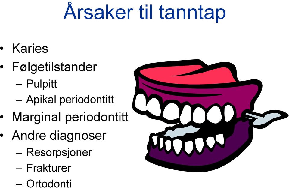 periodontitt Marginal periodontitt