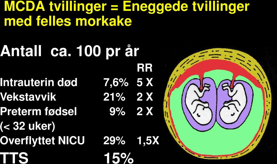 100 pr år RR Intrauterin død 7,6% 5 X