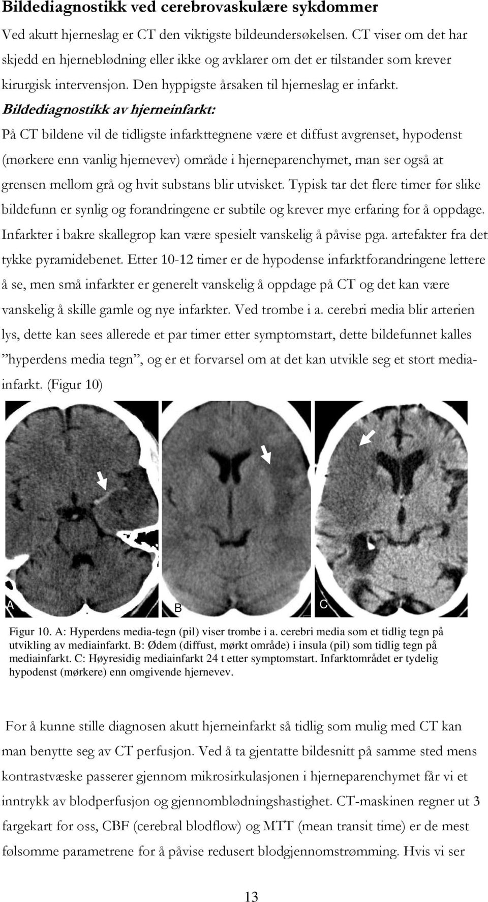 Bildediagnostikk av hjerneinfarkt: På CT bildene vil de tidligste infarkttegnene være et diffust avgrenset, hypodenst (mørkere enn vanlig hjernevev) område i hjerneparenchymet, man ser også at