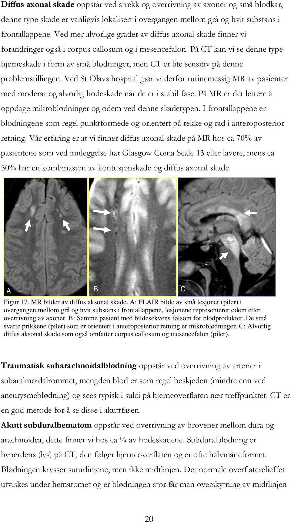 På CT kan vi se denne type hjerneskade i form av små blødninger, men CT er lite sensitiv på denne problemstillingen.