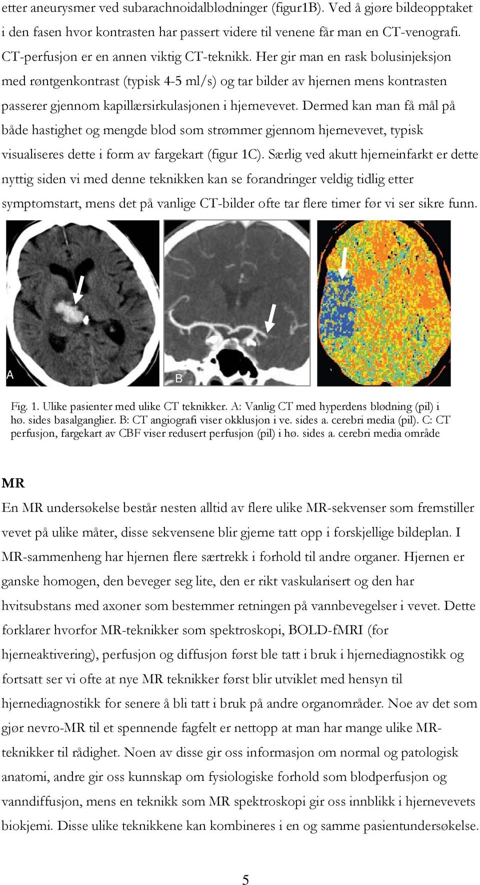 Her gir man en rask bolusinjeksjon med røntgenkontrast (typisk 4-5 ml/s) og tar bilder av hjernen mens kontrasten passerer gjennom kapillærsirkulasjonen i hjernevevet.
