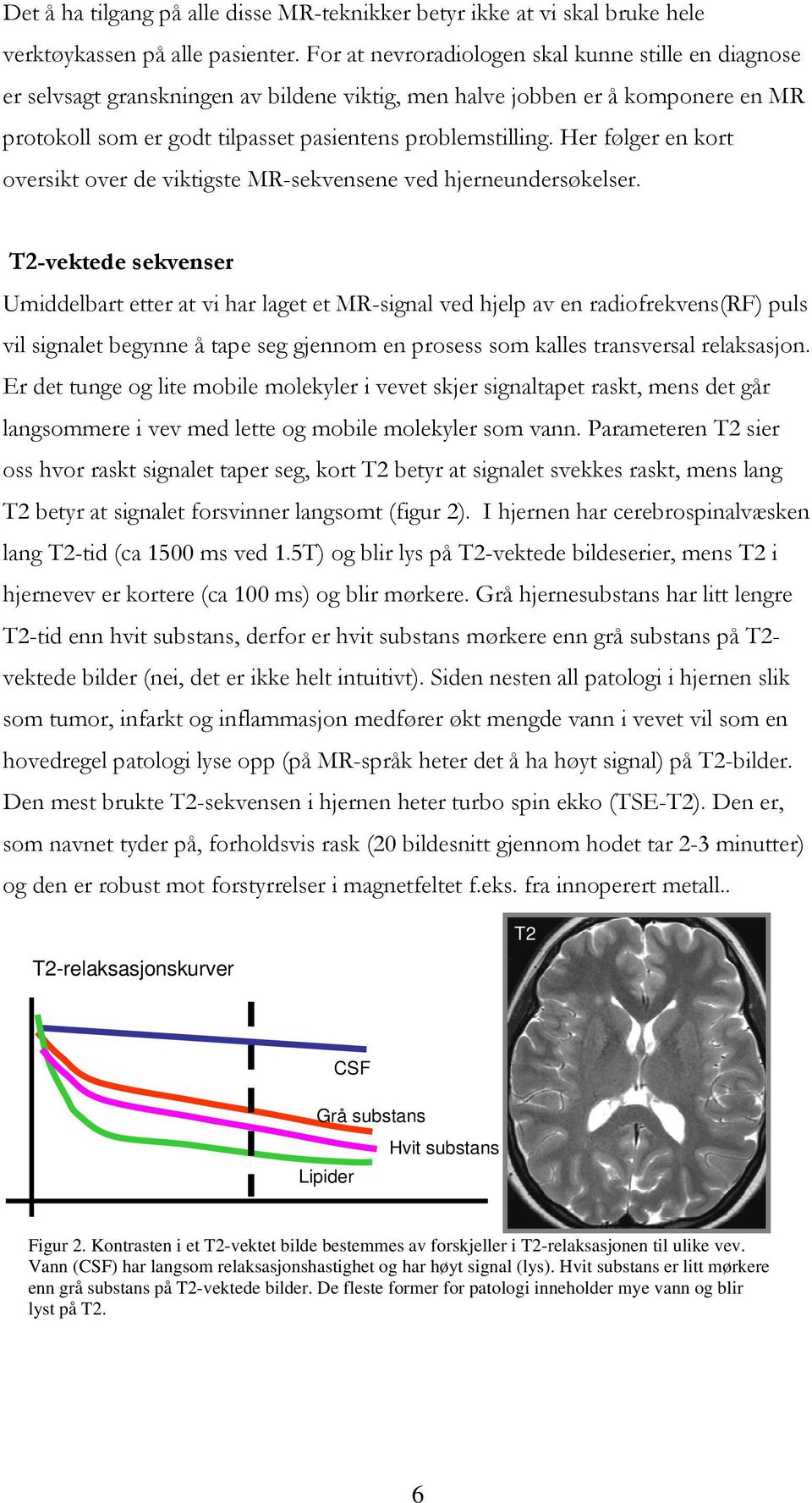 Her følger en kort oversikt over de viktigste MR-sekvensene ved hjerneundersøkelser.