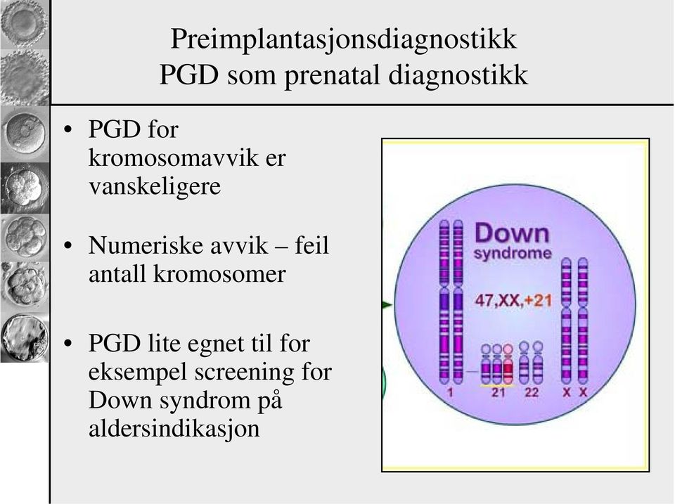 Numeriske avvik feil antall kromosomer PGD lite