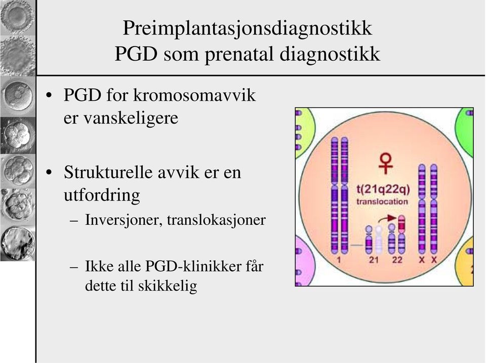 Strukturelle avvik er en utfordring Inversjoner,