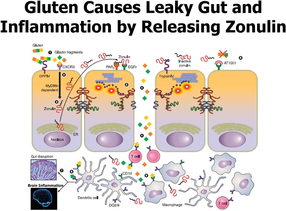 Inflammation by