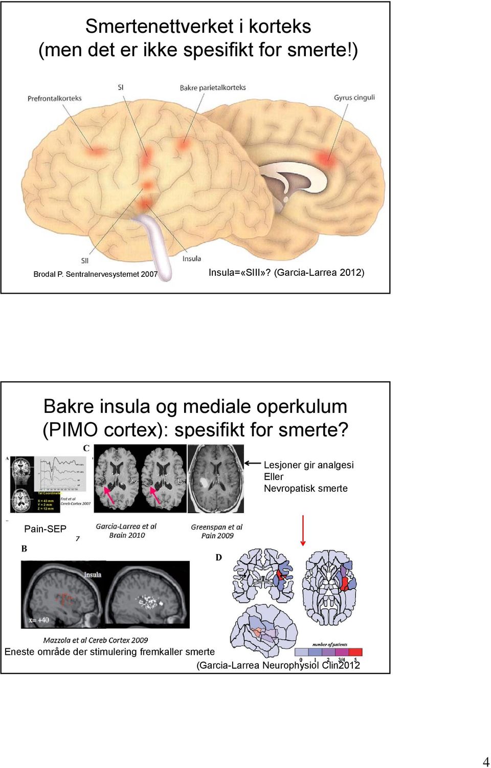 (Garcia-Larrea 2012) Bakre insula og mediale operkulum (PIMO cortex): spesifikt for