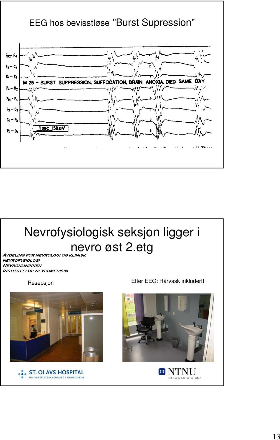 etg Avdeling for nevrologi og klinisk nevrofysiologi