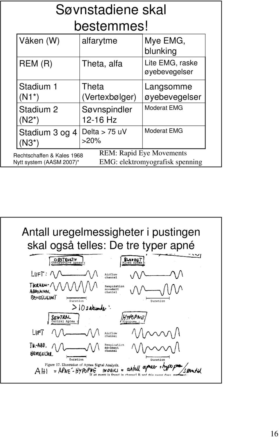alfarytme Theta, alfa Theta (Vertexbølger) Søvnspindler 12-16 Hz Delta > 75 uv >20% Mye EMG, blunking Lite EMG,