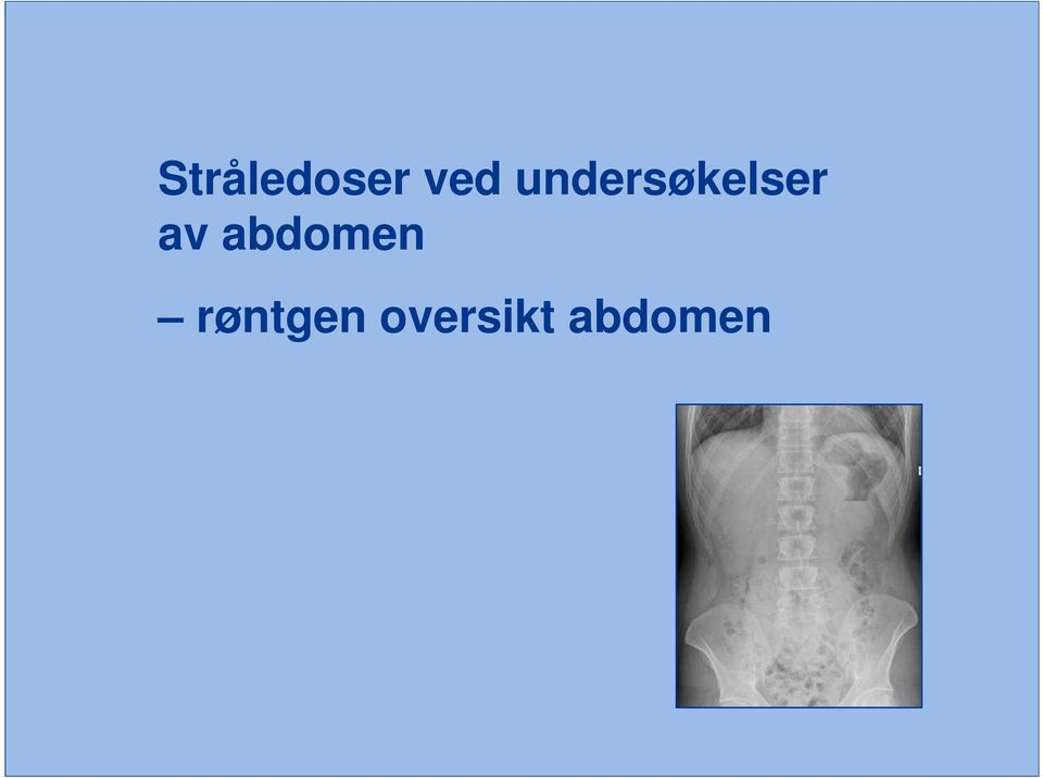 abdomen røntgen