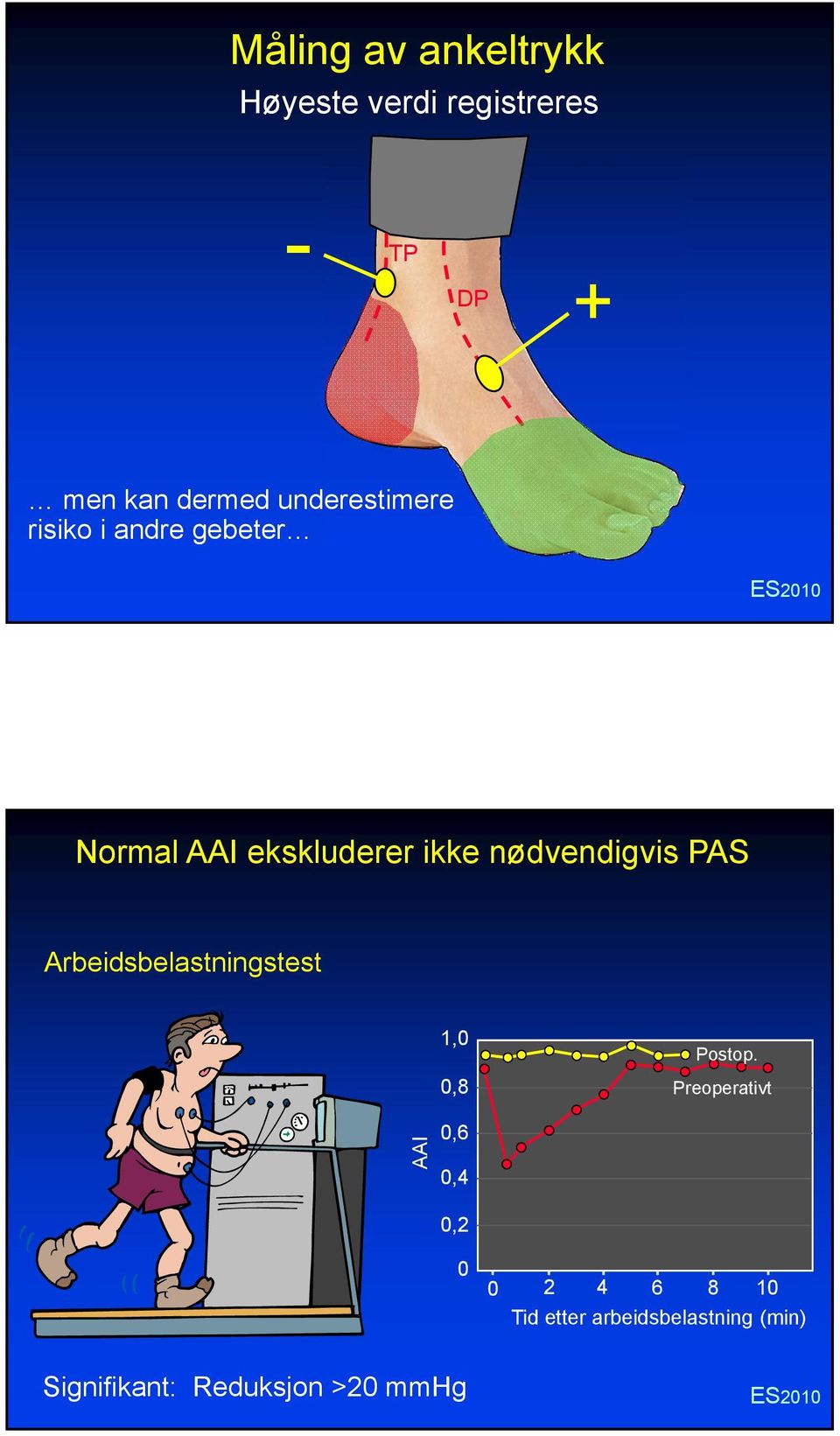 nødvendigvis PAS Arbeidsbelastningstest 1,0 0,8 Postop.