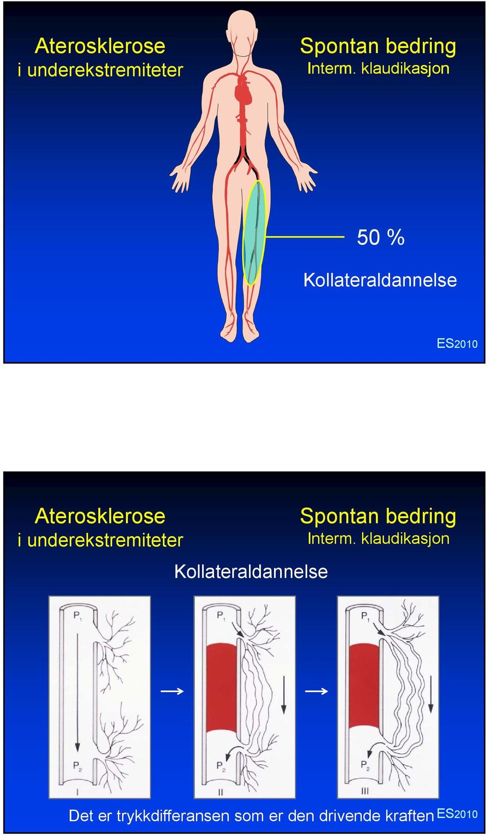 underekstremiteter Kollateraldannelse Spontan bedring