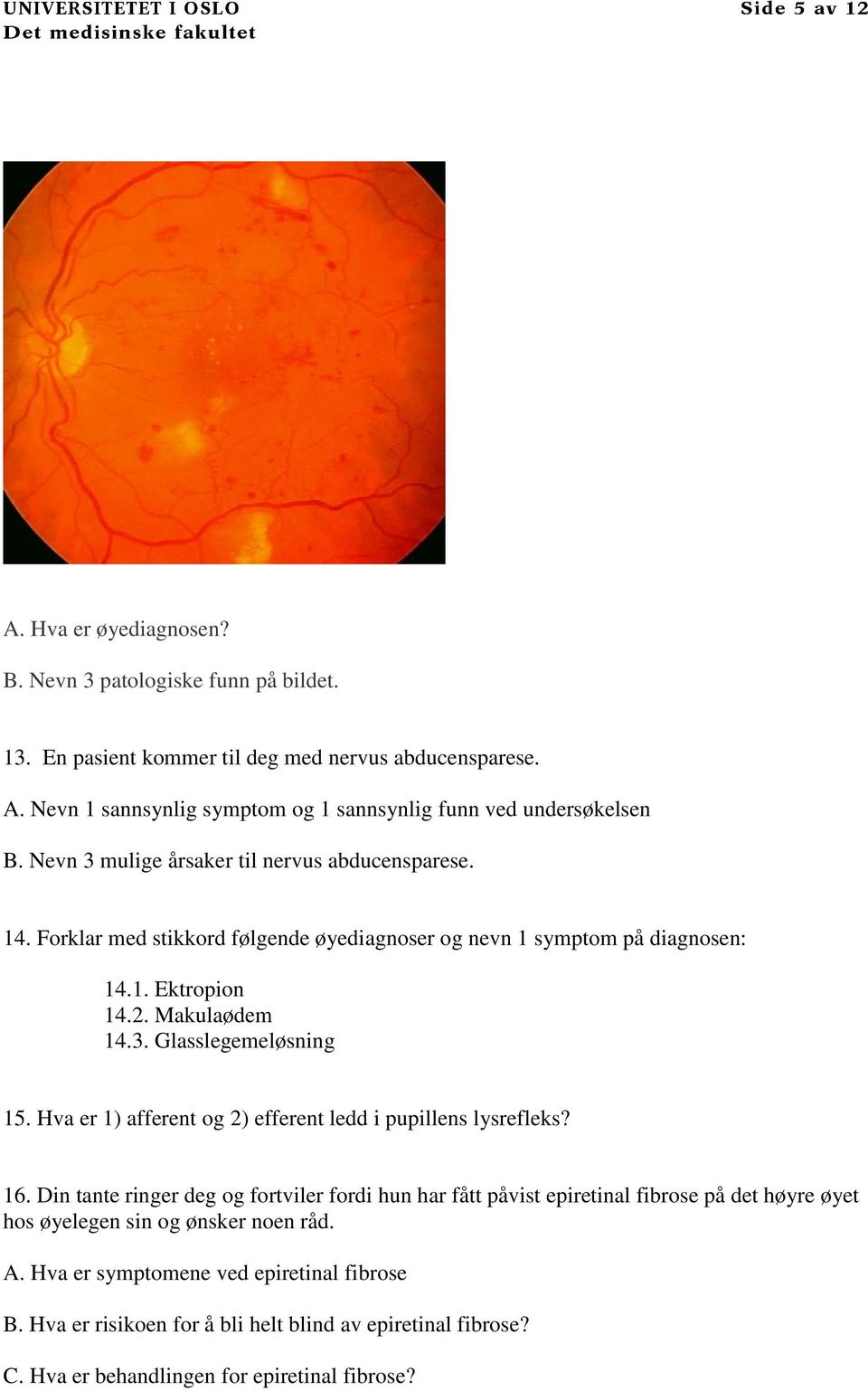 Forklar med stikkord følgende øyediagnoser og nevn 1 symptom på diagnosen: 14.1. Ektropion 14.2. Makulaødem 14.3. Glasslegemeløsning 15.