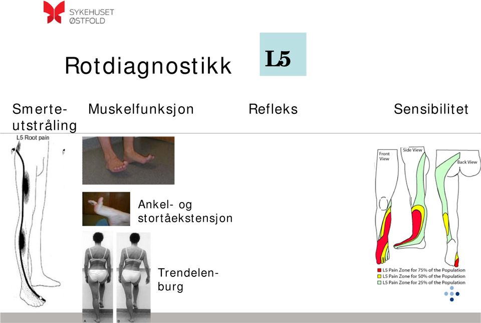 Sensibilitet utstråling