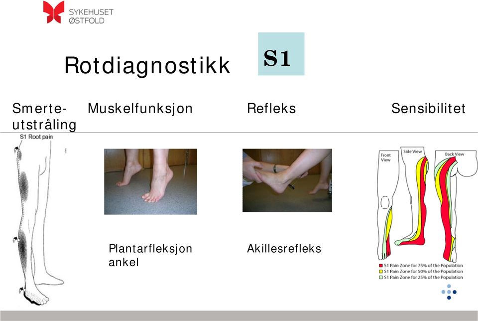 Sensibilitet utstråling