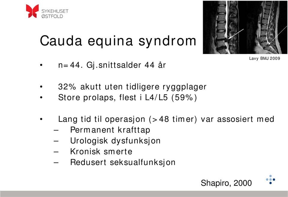 Store prolaps, flest i L4/L5 (59%) Lang tid til operasjon (>48 timer)