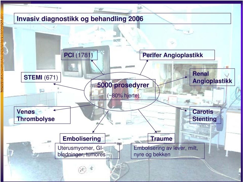 Angioplastikk Venøs Thrombolyse Carotis Stenting Embolisering