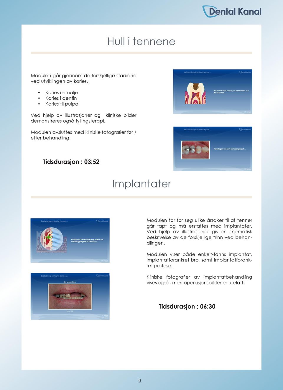 Modulen avsluttes med kliniske fotografier før / etter behandling.