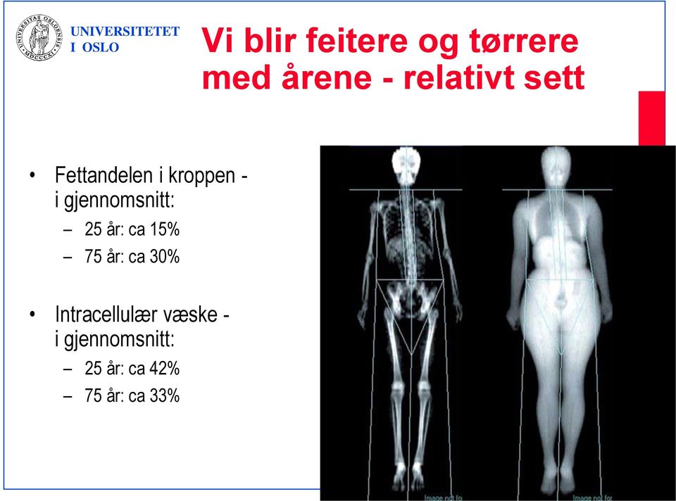 gjennomsnitt: 25 år: ca 15% 75 år: ca 30%