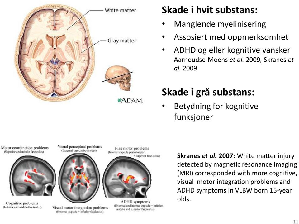 2009 Skade i grå substans: Betydning for kognitive funksjoner Skranes et al.