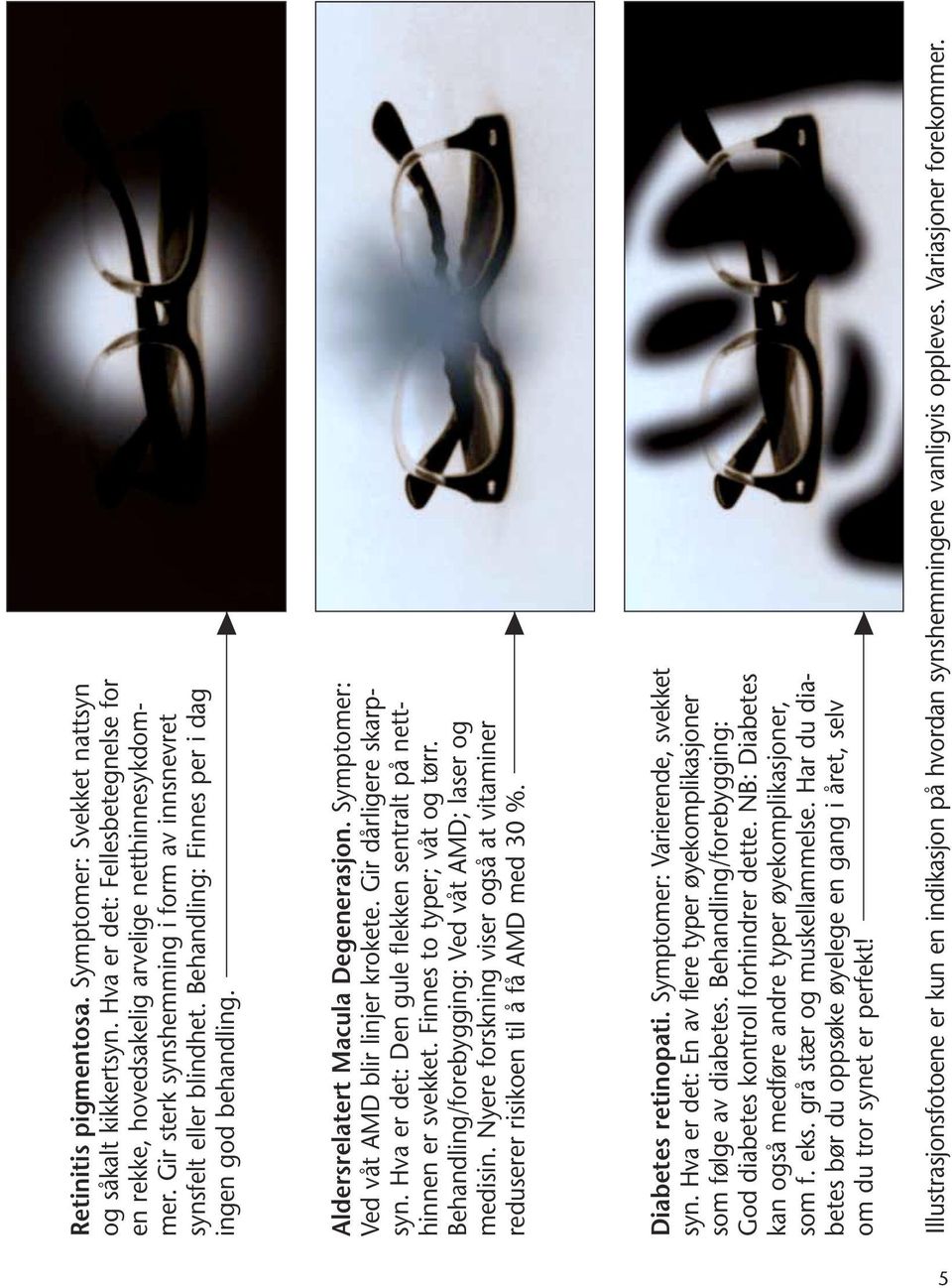 Gir dårligere skarpsyn. Hva er det: Den gule flekken sentralt på netthinnen er svekket. Finnes to typer; våt og tørr. Behandling/forebygging: Ved våt AMD; laser og medisin.