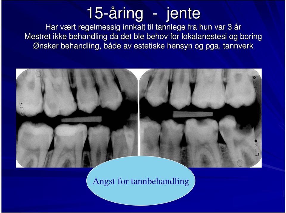 ble behov for lokalanestesi og boring Ønsker behandling,