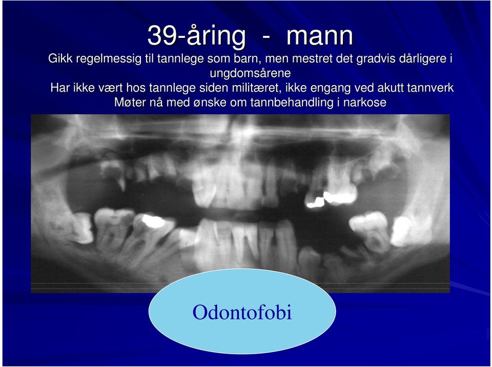 v hos tannlege siden militæret, ikke engang ved akutt