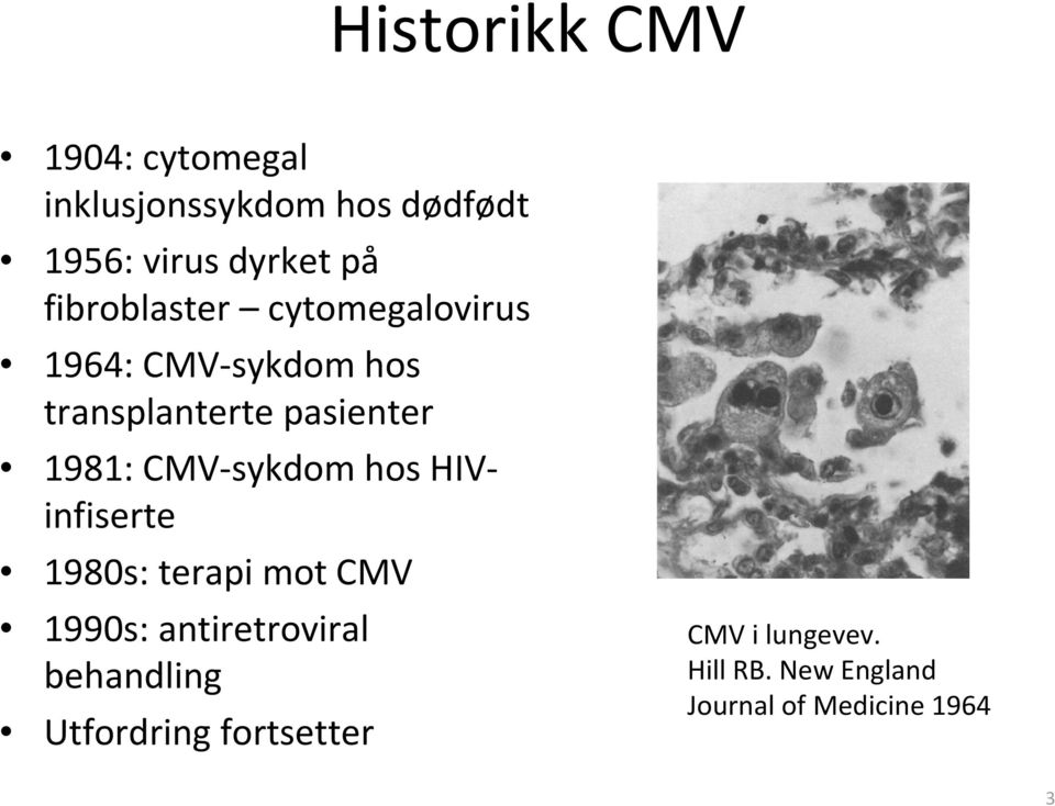 CMV-sykdom hos HIVinfiserte 1980s: terapimot CMV 1990s: antiretroviral behandling