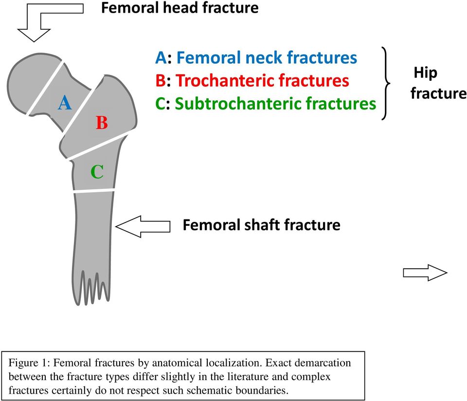 fractures by anatomical localization.