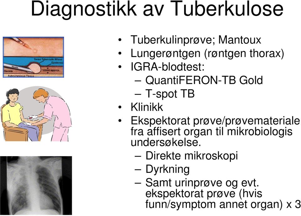 prøve/prøvemateriale fra affisert organ til mikrobiologis undersøkelse.