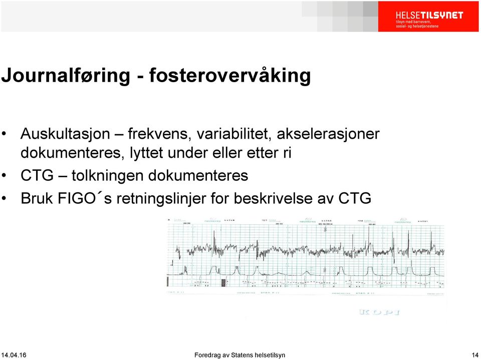 etter ri CTG tolkningen dokumenteres Bruk FIGO s