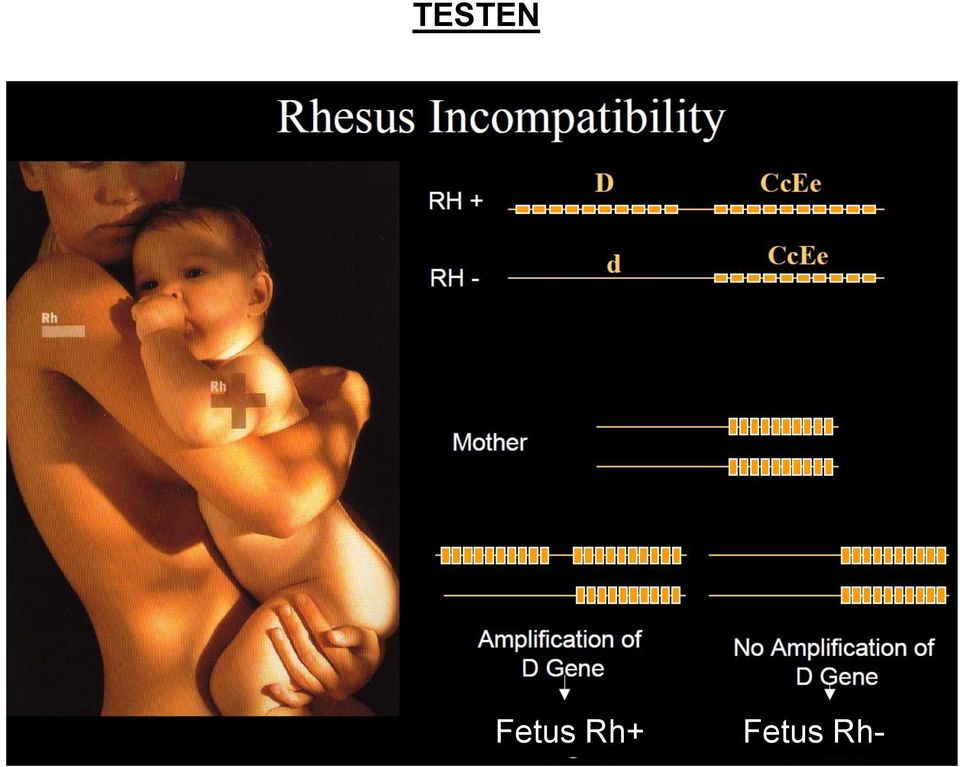 Fetus Rh-