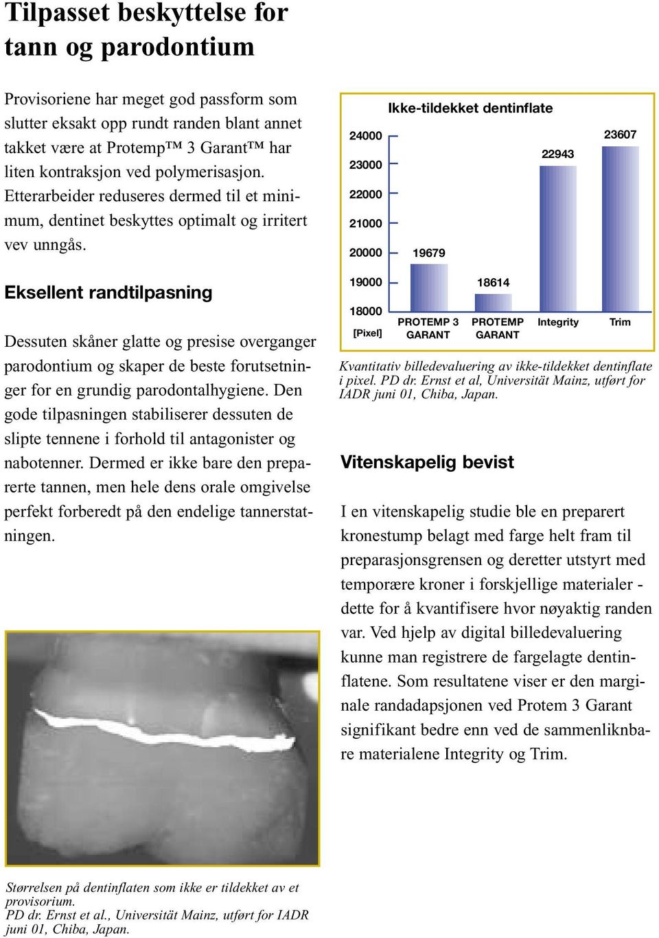 Ikke-tildekket dentinflate 24000 22943 23000 22000 21000 20000 19679 23607 Eksellent randtilpasning Dessuten skåner glatte og presise overganger parodontium og skaper de beste forutsetninger for en