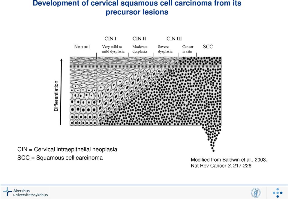 intraepithelial neoplasia SCC = Squamous cell carcinoma