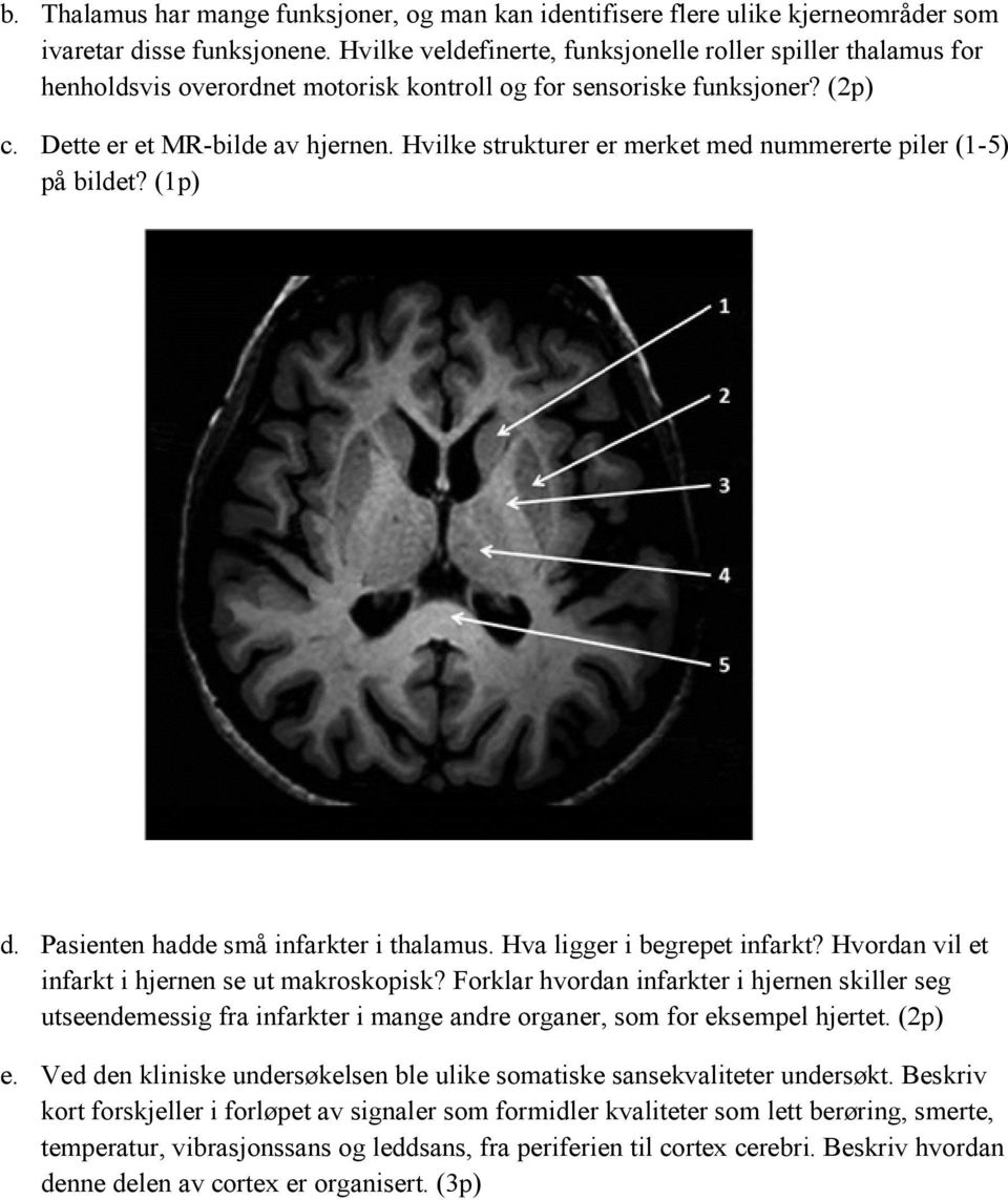 Hvilke strukturer er merket med nummererte piler (1-5) på bildet? (1p) d. Pasienten hadde små infarkter i thalamus. Hva ligger i begrepet infarkt? Hvordan vil et infarkt i hjernen se ut makroskopisk?